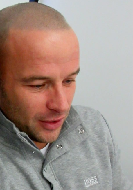 Scalp Micropigmentation